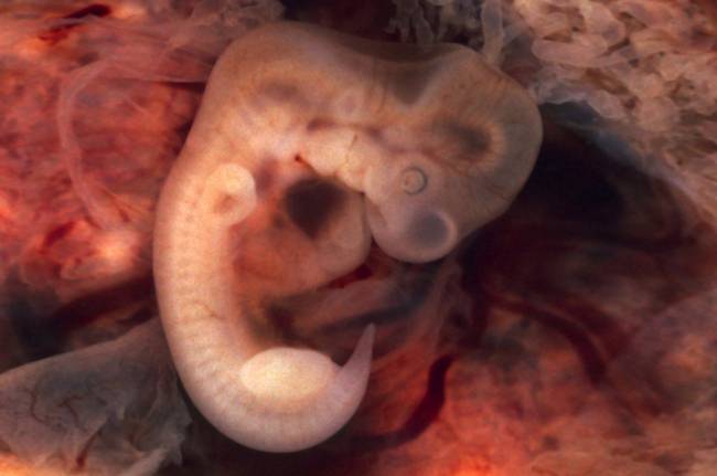 embrión de cinco semanas