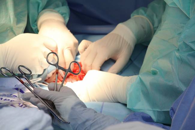 Una operación de transplante de órganos en un quirófano