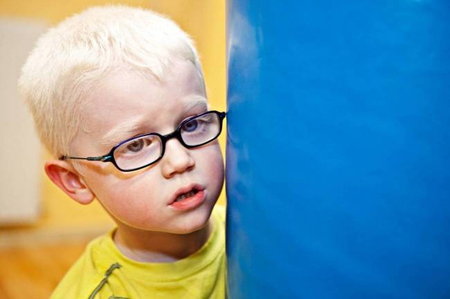 albinismo, enfermedad rara