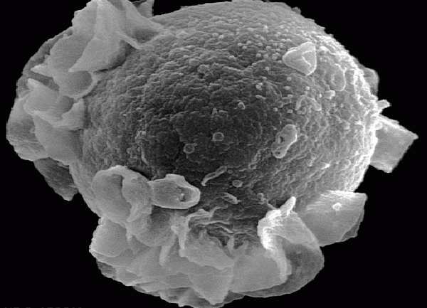 Linfocito B al microscopio electrónico./ James Gathany (CDC)