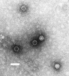 El virus de la poliomelitis. Imagen: Wikipedia.