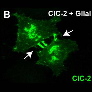 Mutaciones en el gen GlialCAM cambian la distribución subcelular del canal de cloruro CLC2. 