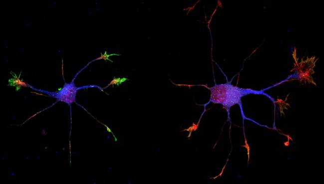 Neuronas de hipocampo