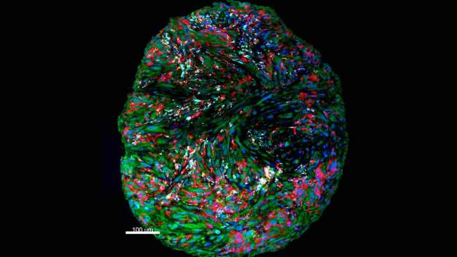 Imagen de microscopía multicolor de los componentes del sistema inmunitario tras el tratamiento de inmunoterapia