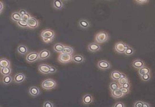Levadura BM60, la Saccharomyces cerevisiae. 