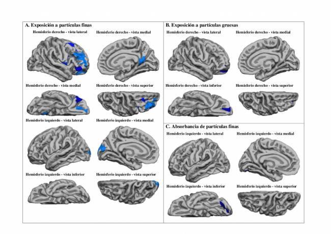Imágenes que muestran las regiones cerebrales afectadas por las partículas finas y gruesas