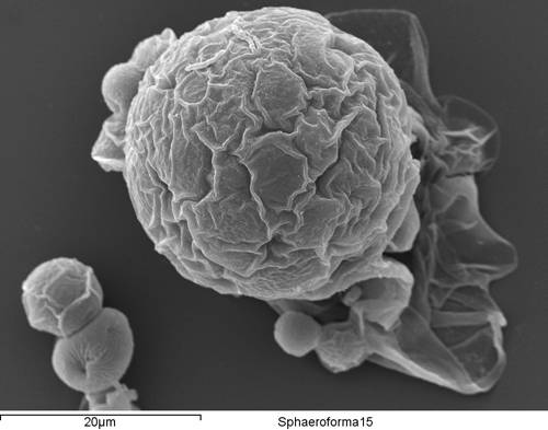 Sphaeroforma arctica, organismo unicelular la familia de los ictiosporeos. Imagen: Arnau Sebé-Pedrós, Instituto de Biología Evolutiva (CSIC-UPF)