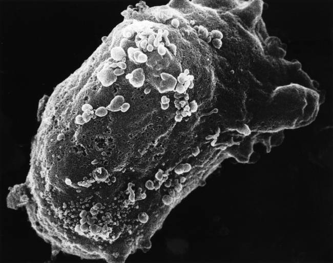 Vista al microscopio electrónico de un linfocito con VIH. / National Cancer Institute