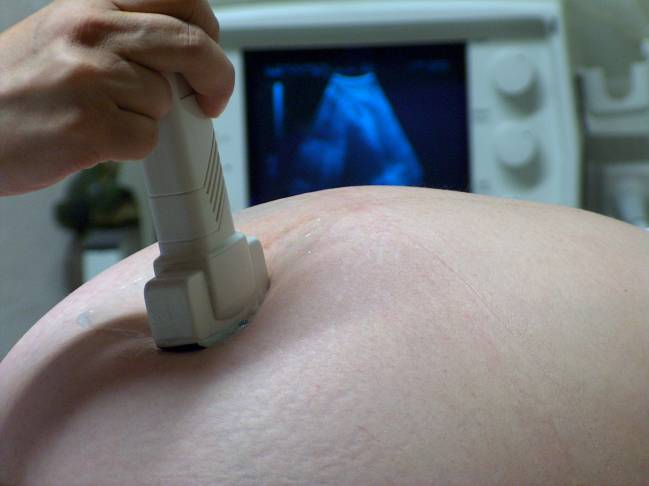 mujer embarazada en el ultrasonido