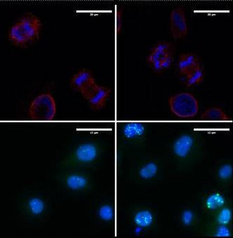 Las células del melanoma son adictas a la proteína LOXL3
