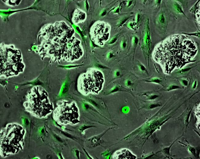 células cancerígenas