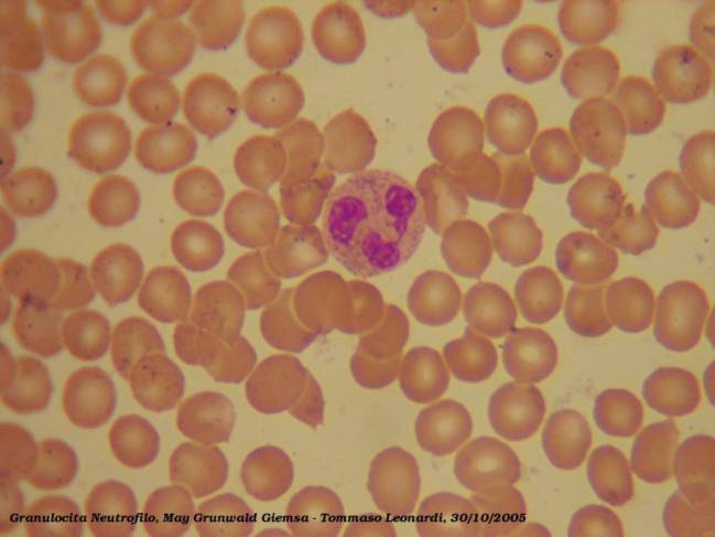 Neutrófilo en un frotis sanguíneo, rodeado de glóbulos rojos. / Wikipedia