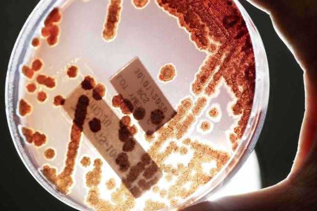 Placa petri con bacterias