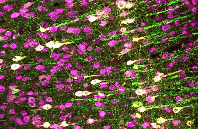 Neuronas activadas (blanco) y no mediante sonidos en el cerebro del ratón