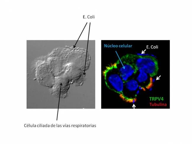 Ataque de bacterias escherichia coli a las células ciliadas del pulmón - UPF