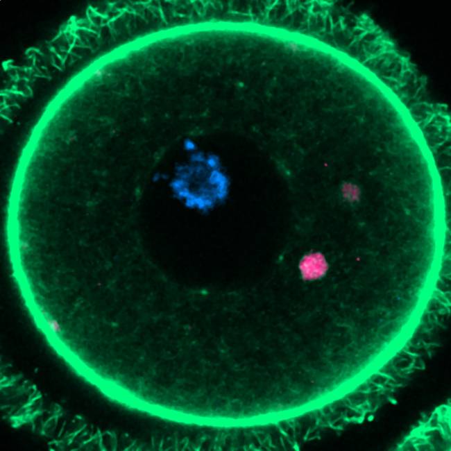 ELVA en fluorescencia (magenta) dentro de un óvulo de ratón