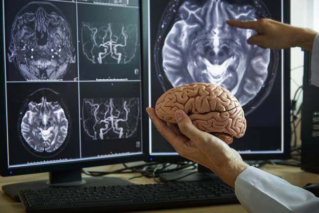 Investigadores observan fotos del cerebro humano