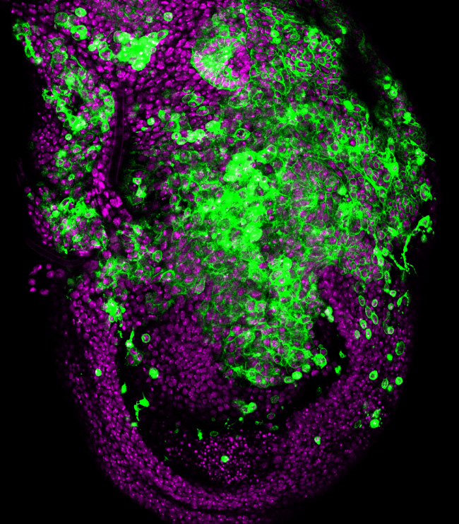 Invasión celular en Drosophila