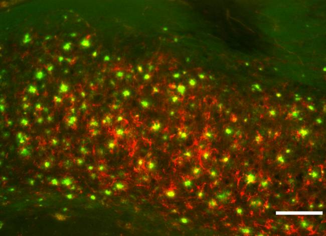 Sección de cerebro de un ratón transgénico para EA mostrando acumulaciones de placas amiloides (verde) y ferritina (rojo). Barra de escala: 100m. Fuente: ACS Chem. Neurosci., 2018, 9 (5), pp 912–924