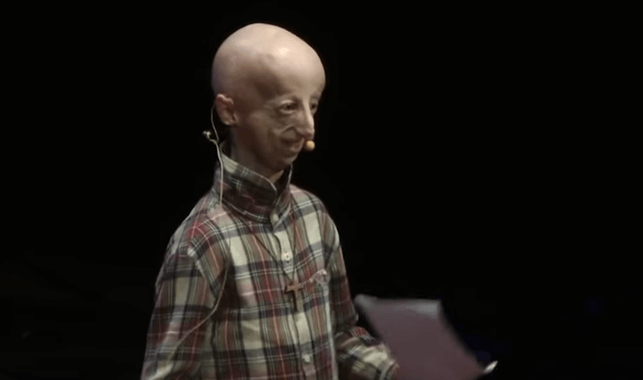Sammy Basso, enfermo de progeria, durante una charla TedX 