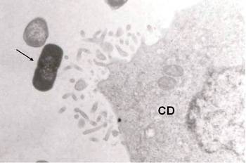 Lactobacillus gasseri-UCM