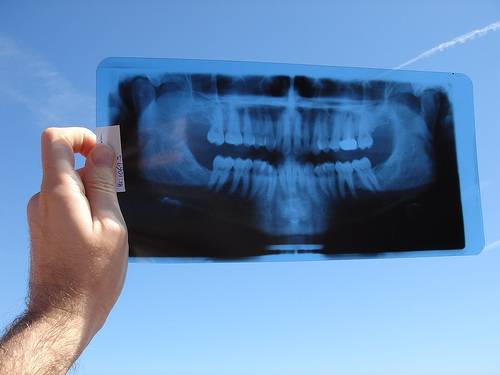 Los rayos x se utilizan para tomar radiografías. Foto: GàbiaD'Esquirol.