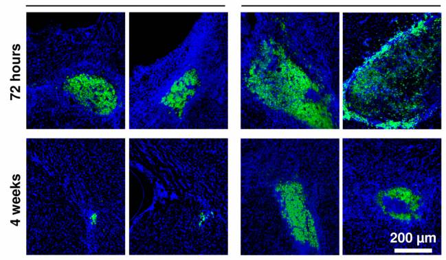 Imágenes de microscopia de fluorescencia mostrando células madre injertadas en el tejido cerebral