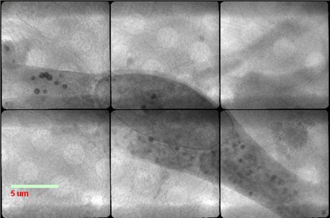 EPC visualizada en el microscopio de transmisión de rayos X del Sincrotrón ALBA. / VHIR