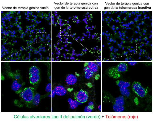 Pulmones tratados con los vectores de terapia génica con telomerasa