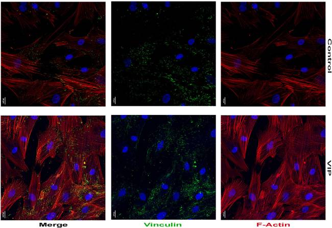 Fotomicrografías del efecto del péptido intestinal vasoactivo (VIP) sobre el citoesqueleto y osteoblastos