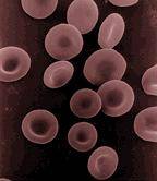 Glóbulos rojos. Imagen: Wikipedia.