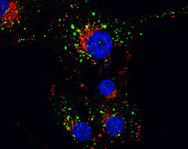 Efecto del tratamiento con THC en los autofagosomas (verde) y lisosomas (rojo) de células de glioma. Autor: Guillermo Velasco.