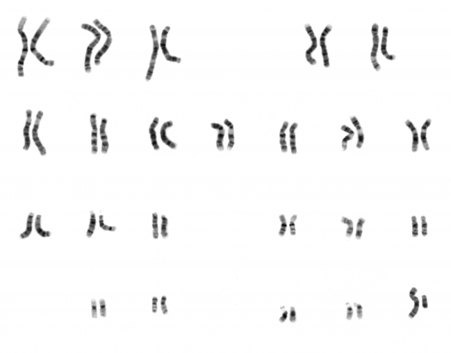 Imagen de los cromosomas de un ser humano. Imagen: Wikipedia