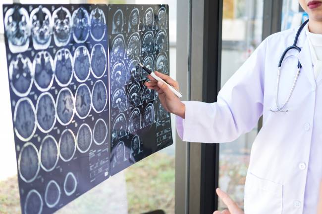 Doctor mira la resonancia magnética del cerebro de un paciente