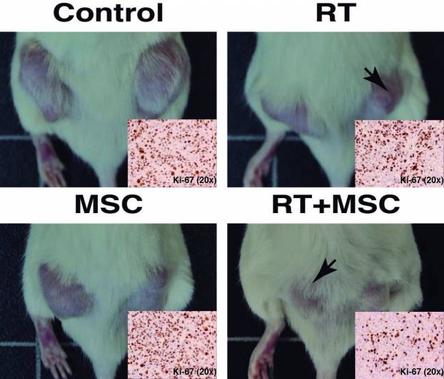 La imagen muestra cuatro animales con dos tumores cada uno. Las fotografías son representativas del crecimiento de los tumores en los grupos Control (sin tratar), tratados sólo con radioterapia (RT), tratados con células mesenquimales (MSC) y tratados con la combinación de células mesenquimales y radioterapia (RT+MSC). 