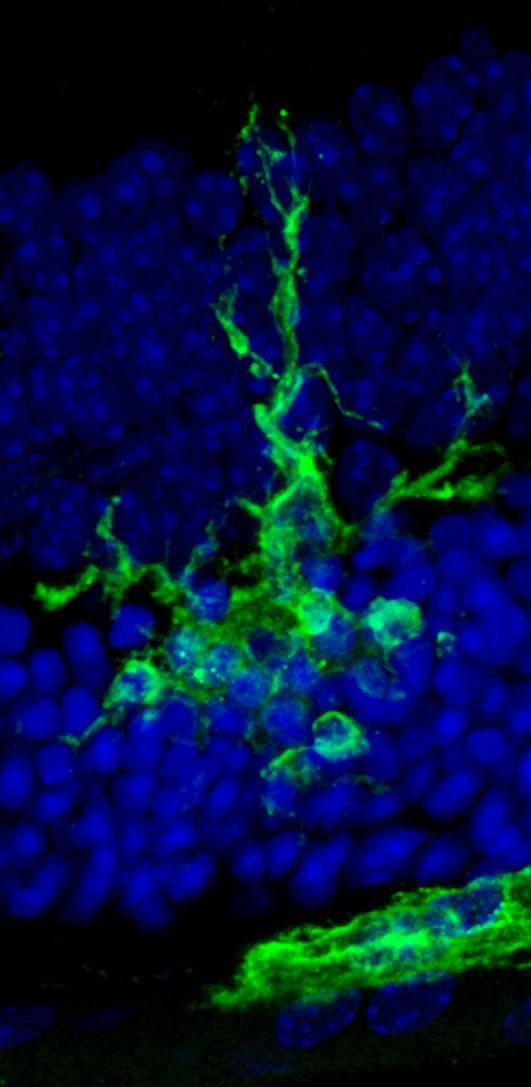 Célula microglial en verde