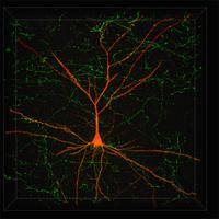 Imagen virtual de una neurona para su reclasificación. FIUPM