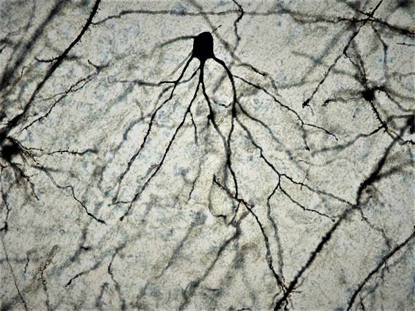 Neurona de cerebro de ratón a 100x tras tinción de Golgi-Cox. / Facultad de Medicina UCM.