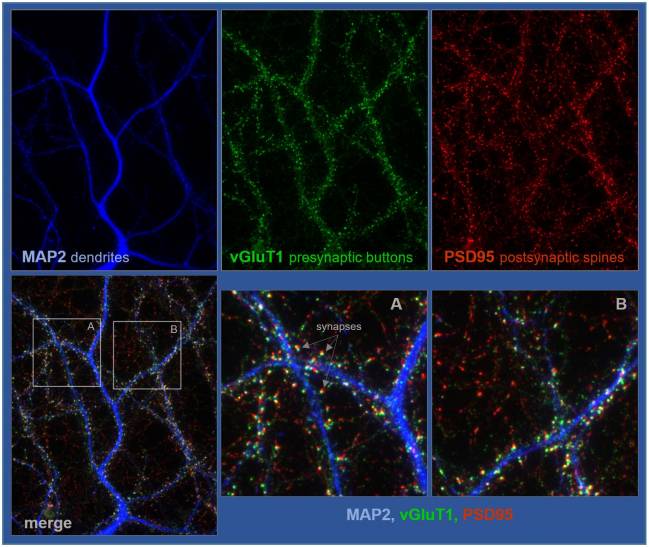 Detalle de neuronas de hipocampo crecidas durante 18 días, fijadas y procesadas para analizar sinapsis excitadoras. 