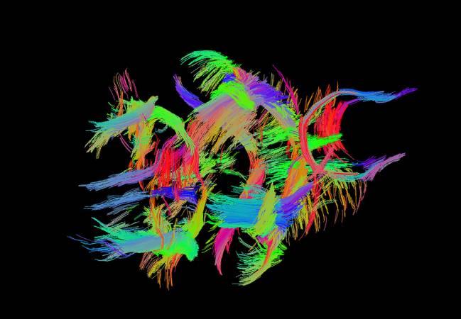 Tractografía que reproduce los haces de sustancia blanca del cerebro de un ratón. / NIH.