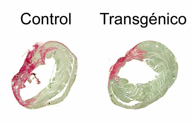 La sobreexpresión de la calcineurina CnAbeta1 en el corazón de ratones transgénicos reduce la región infartada. 