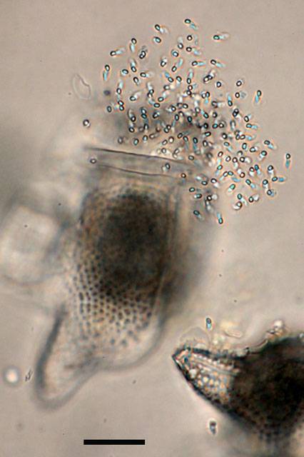 Imagen de microscopio óptico en la que se ven a los parásitos saliendo del esporangio que han formado dentro del hospedador, en este caso la microalga Dinophysis caudata (con forma de copa), a la búsqueda de nuevos hospedadores