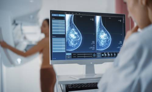 mamografía, cáncer de mama