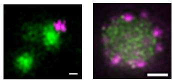 Unión del PF4 (verde) a conglomerados de proteínas de la vacuna (morado). Imagen obtenida por microscopía de superresolución