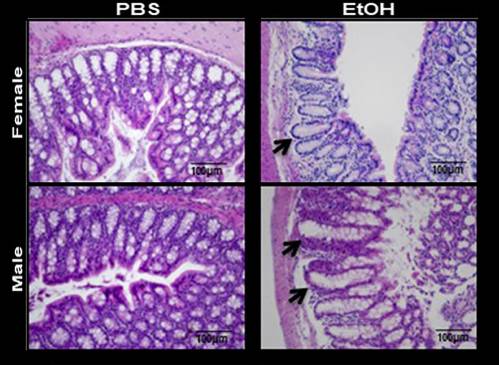 La barrera intestinal en el intestino grueso de ratones hembra se mantiene parcialmente en comparación con los machos
