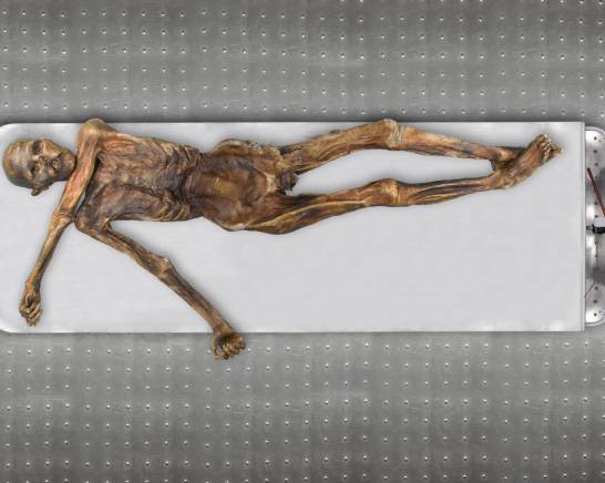 The Iceman Ötzi was bald, dark-skinned, and of Anatolian descent.