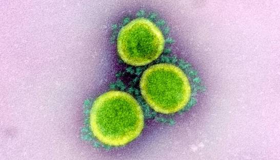 La-OMS-confirma-que-el-coronavirus-no-vi
